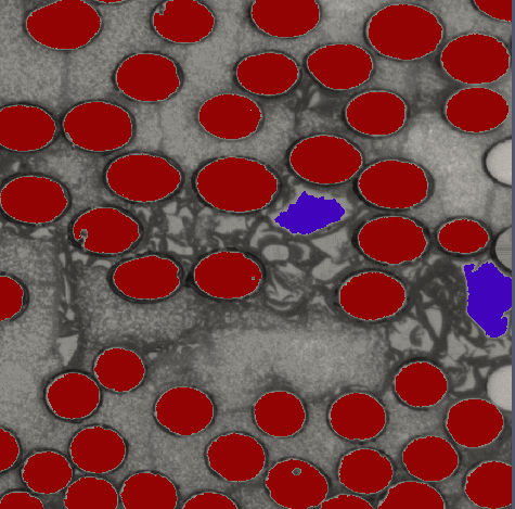 Example appllication of filter to identify elliptical particales (red) which are differentiated from non-elliptical particals (purple)